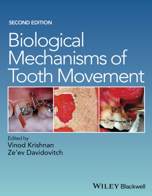 Biological Mechanisms of Tooth Movement, Hardback Book