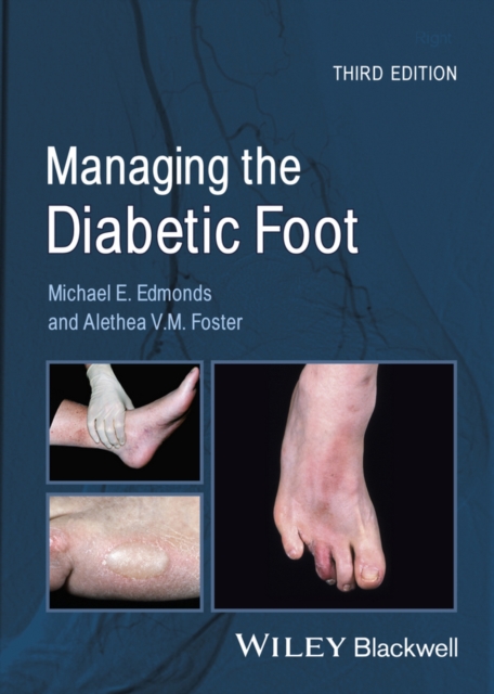 Managing the Diabetic Foot, EPUB eBook