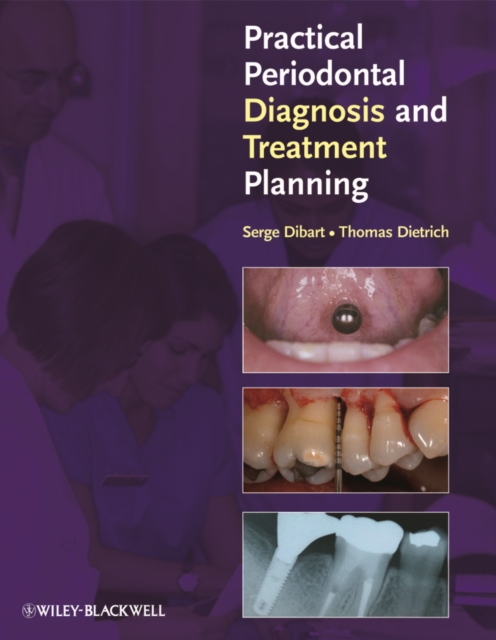 Practical Periodontal Diagnosis and Treatment Planning, EPUB eBook