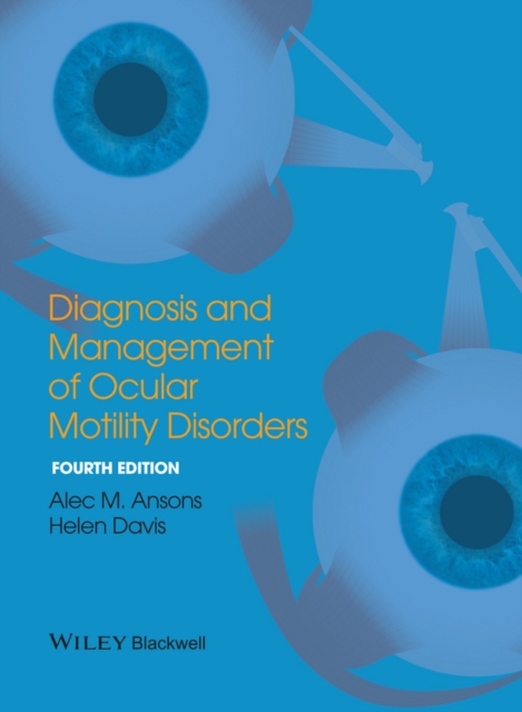 Diagnosis and Management of Ocular Motility Disorders, PDF eBook