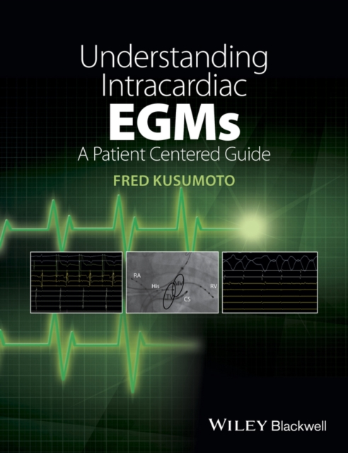 Understanding Intracardiac EGMs : A Patient Centered Guide, PDF eBook