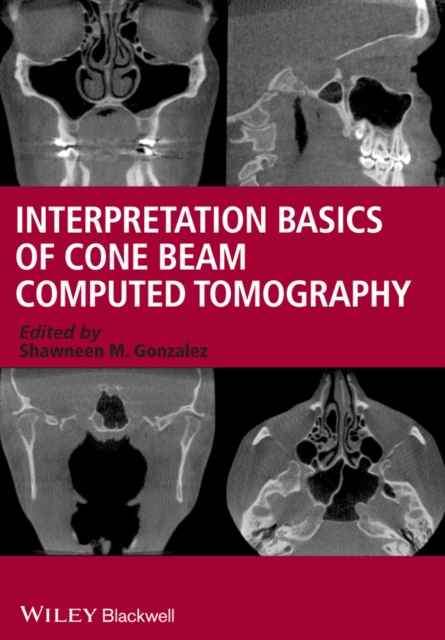 Interpretation Basics of Cone Beam Computed Tomography, EPUB eBook