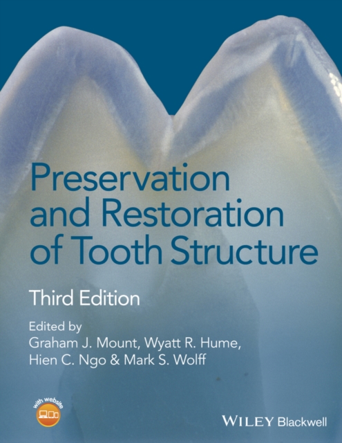 Preservation and Restoration of Tooth Structure, EPUB eBook