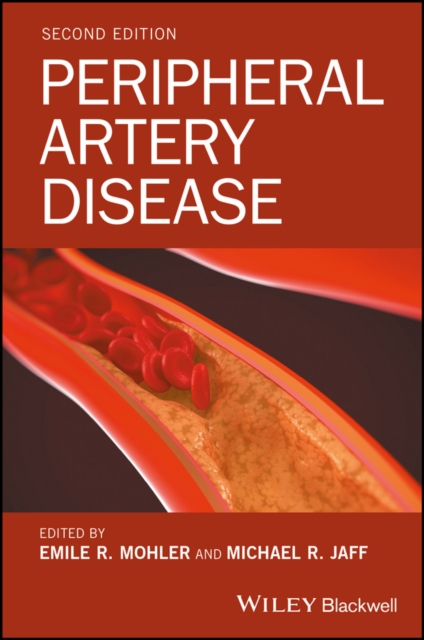 Peripheral Artery Disease, PDF eBook