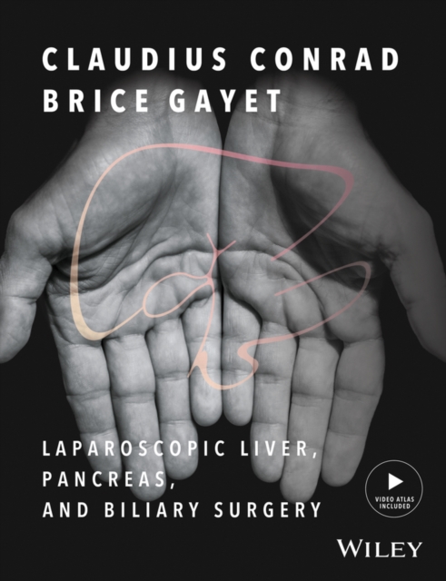 Laparoscopic Liver, Pancreas, and Biliary Surgery, PDF eBook