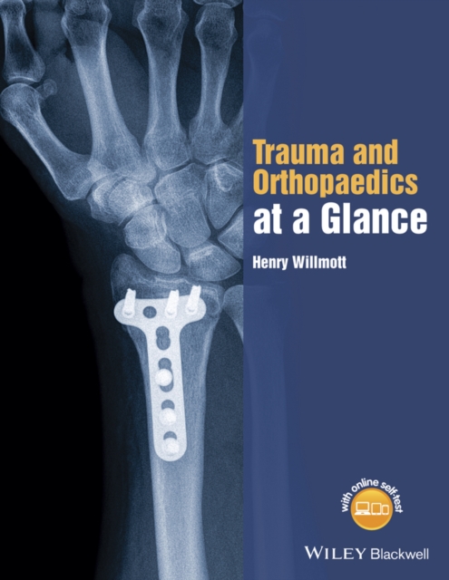 Trauma and Orthopaedics at a Glance, Paperback / softback Book
