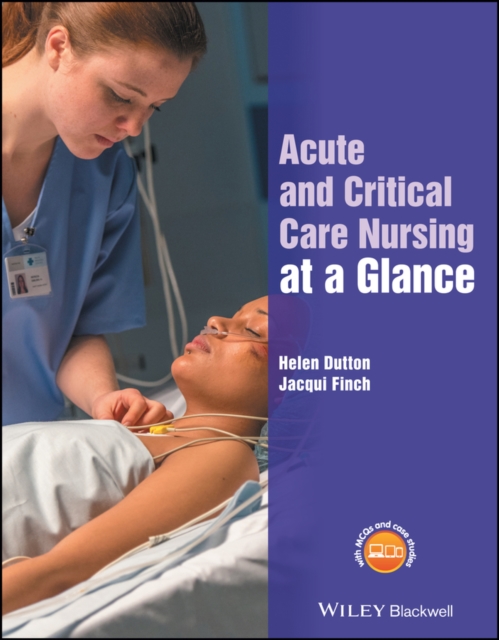 Acute and Critical Care Nursing at a Glance, EPUB eBook