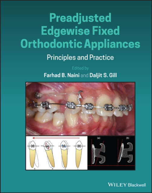 Preadjusted Edgewise Fixed Orthodontic Appliances : Principles and Practice, EPUB eBook