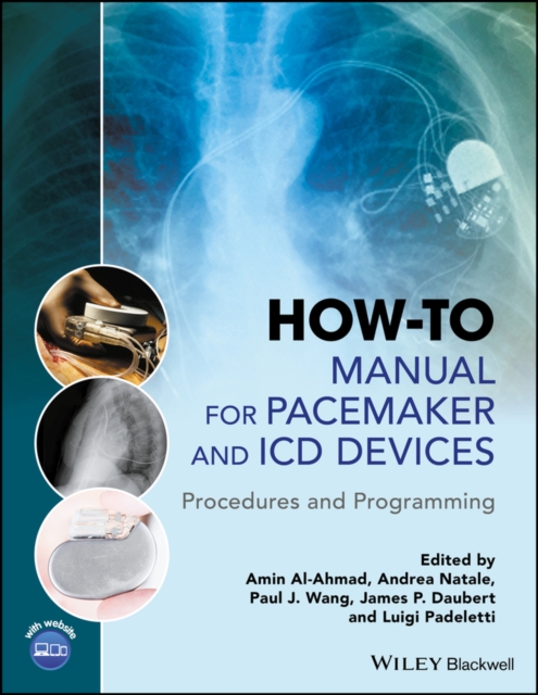 How-to Manual for Pacemaker and ICD Devices : Procedures and Programming, EPUB eBook