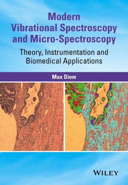 Modern Vibrational Spectroscopy and Micro-Spectroscopy : Theory, Instrumentation and Biomedical Applications, PDF eBook