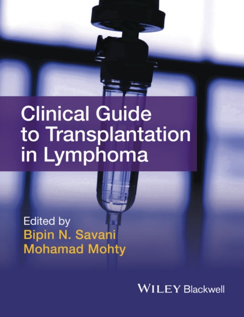 Clinical Guide to Transplantation in Lymphoma, EPUB eBook