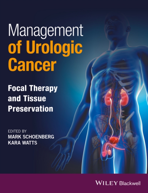 Management of Urologic Cancer : Focal Therapy and Tissue Preservation, Hardback Book