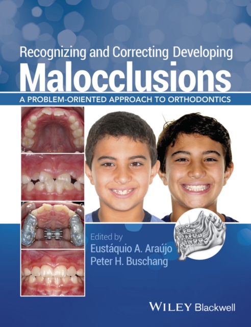 Recognizing and Correcting Developing Malocclusions : A Problem-Oriented Approach to Orthodontics, Paperback / softback Book