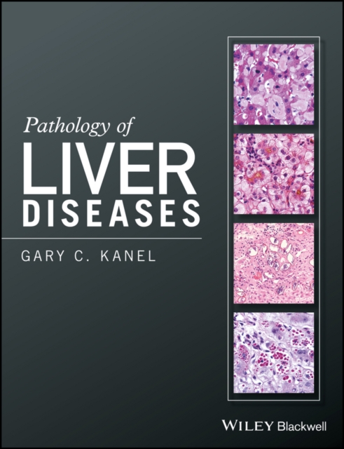 Pathology of Liver Diseases, Hardback Book
