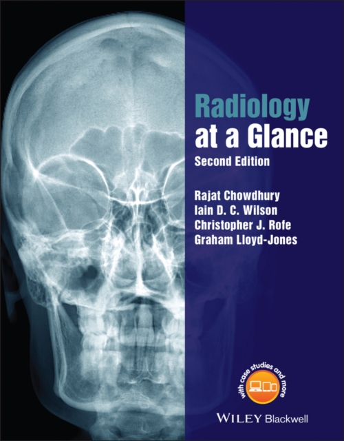 Radiology at a Glance, Paperback / softback Book
