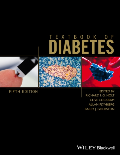 Textbook of Diabetes, EPUB eBook