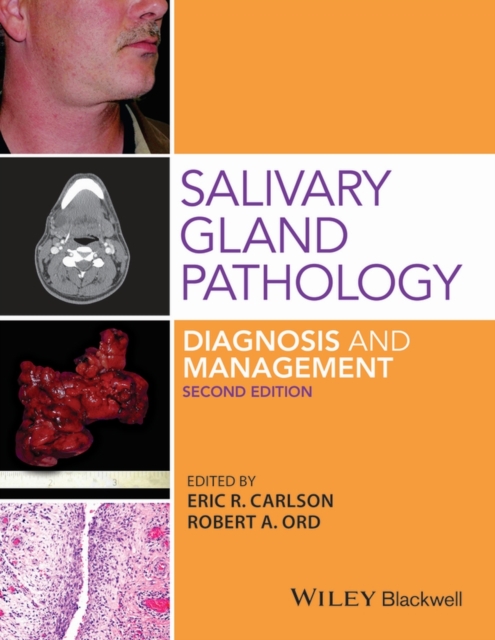 Salivary Gland Pathology : Diagnosis and Management, Hardback Book