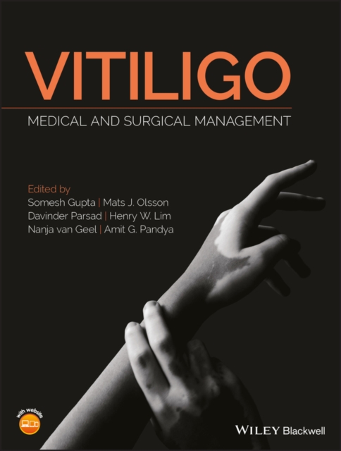 Vitiligo : Medical and Surgical Management, EPUB eBook