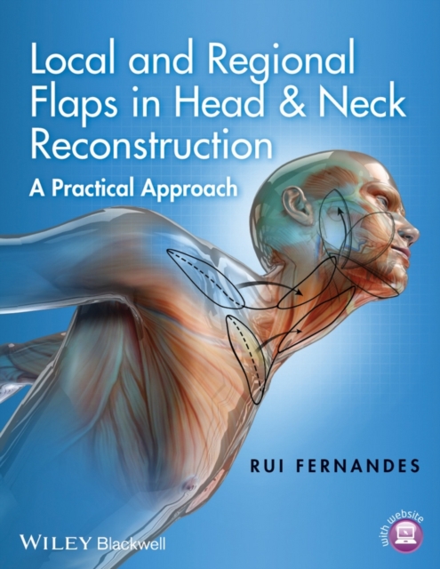 Local and Regional Flaps in Head and Neck Reconstruction : A Practical Approach, EPUB eBook