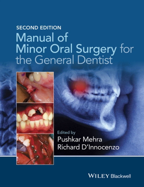 Manual of Minor Oral Surgery for the General Dentist, PDF eBook