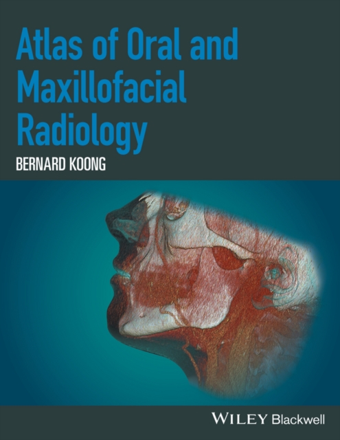 Atlas of Oral and Maxillofacial Radiology, PDF eBook