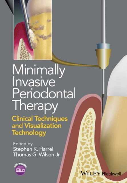 Minimally Invasive Periodontal Therapy : Clinical Techniques and Visualization Technology, PDF eBook