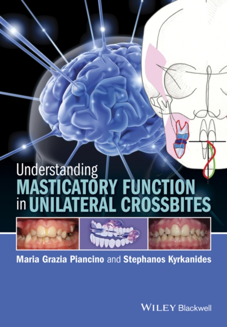 Understanding Masticatory Function in Unilateral Crossbites, Hardback Book