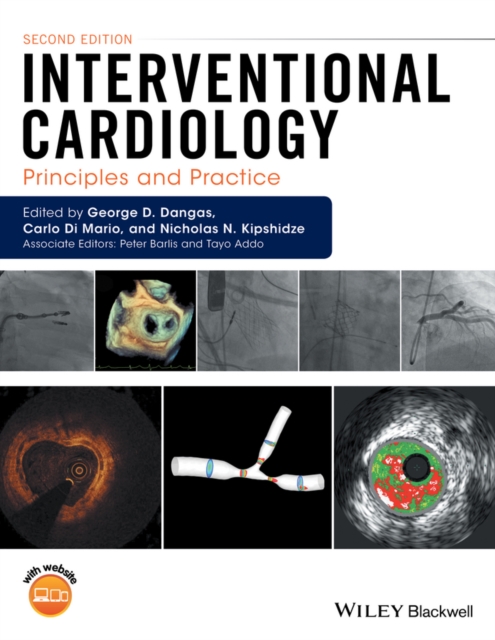 Interventional Cardiology : Principles and Practice, EPUB eBook
