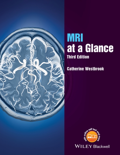 MRI at a Glance, PDF eBook