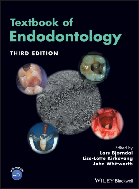 Textbook of Endodontology, PDF eBook