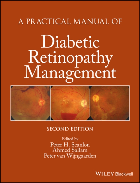 A Practical Manual of Diabetic Retinopathy Management, EPUB eBook