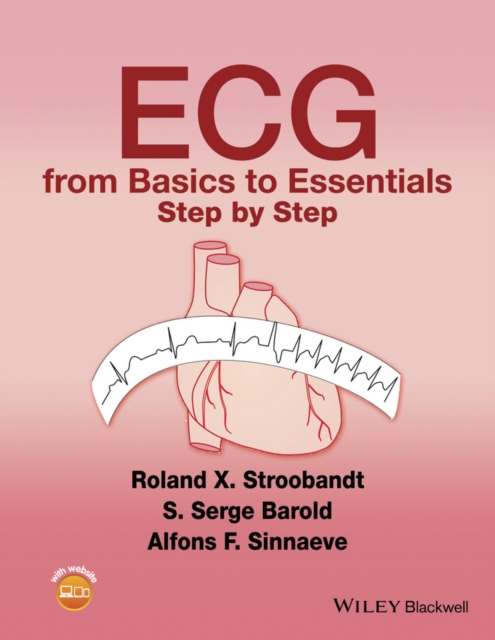 ECG from Basics to Essentials : Step by Step, Paperback / softback Book