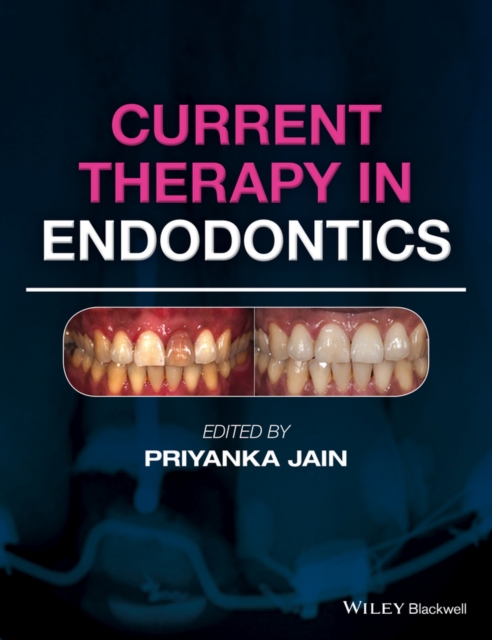 Current Therapy in Endodontics, Hardback Book