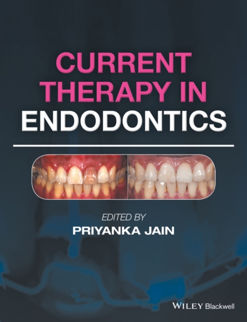 Current Therapy in Endodontics, PDF eBook