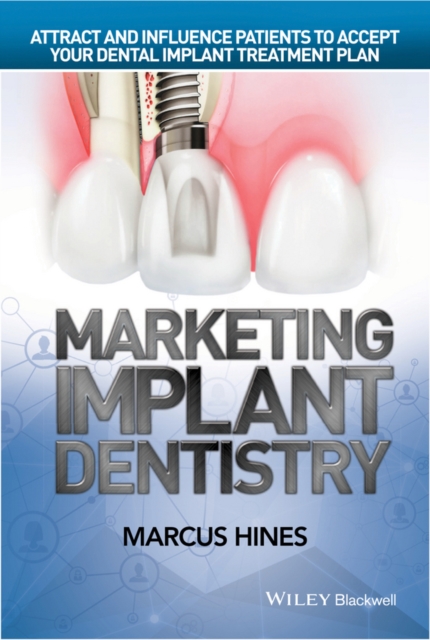 Marketing Implant Dentistry : Attract and Influence Patients to Accept Your Dental Implant Treatment Plan, Hardback Book