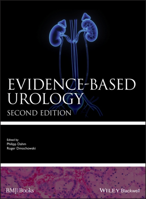 Evidence-based Urology, PDF eBook