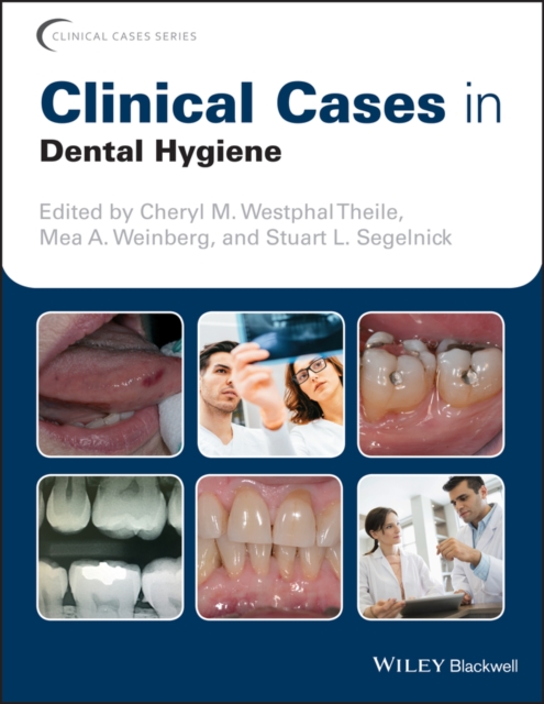 Clinical Cases in Dental Hygiene, Paperback / softback Book