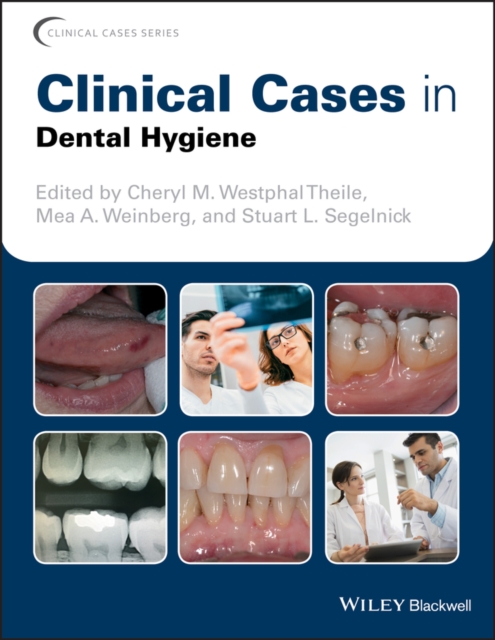 Clinical Cases in Dental Hygiene, PDF eBook