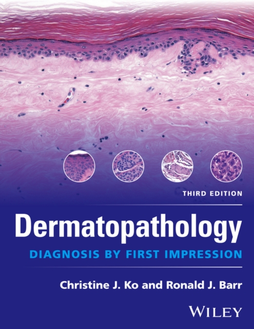 Dermatopathology : Diagnosis by First Impression, Paperback / softback Book