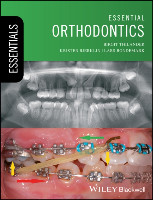Essential Orthodontics, EPUB eBook