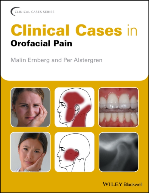 Clinical Cases in Orofacial Pain, EPUB eBook