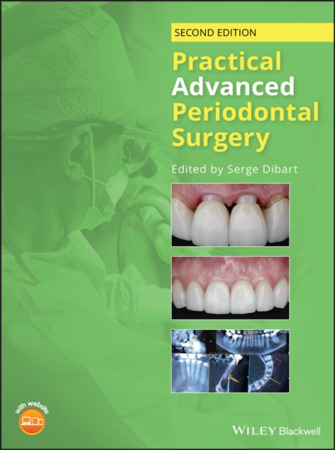 Practical Advanced Periodontal Surgery, Hardback Book