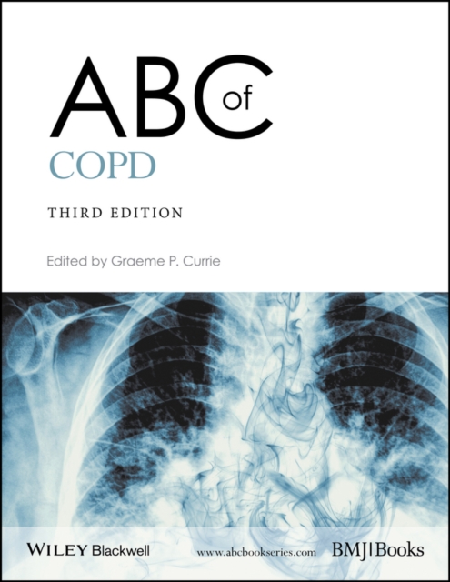 ABC of COPD, Paperback / softback Book