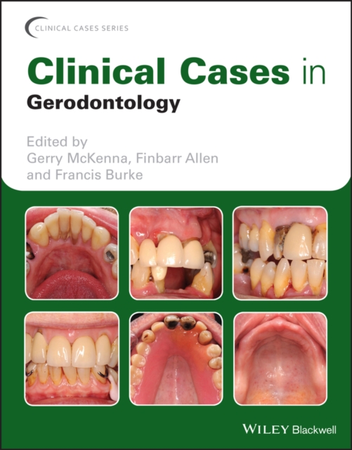 Clinical Cases in Gerodontology, Paperback / softback Book