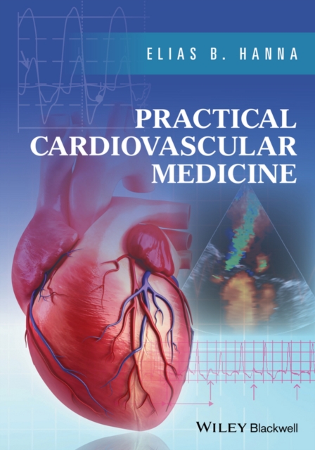 Practical Cardiovascular Medicine, Paperback / softback Book