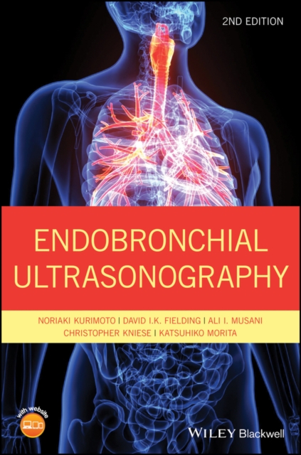 Endobronchial Ultrasonography, PDF eBook