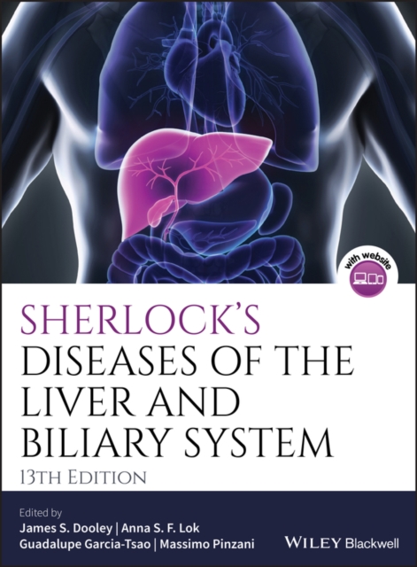 Sherlock's Diseases of the Liver and Biliary System, EPUB eBook