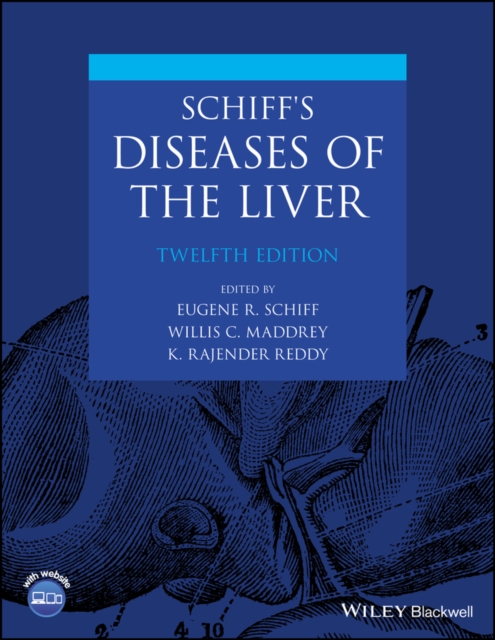 Schiff's Diseases of the Liver, EPUB eBook