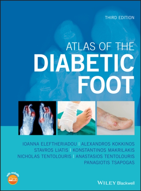 Atlas of the Diabetic Foot, Hardback Book