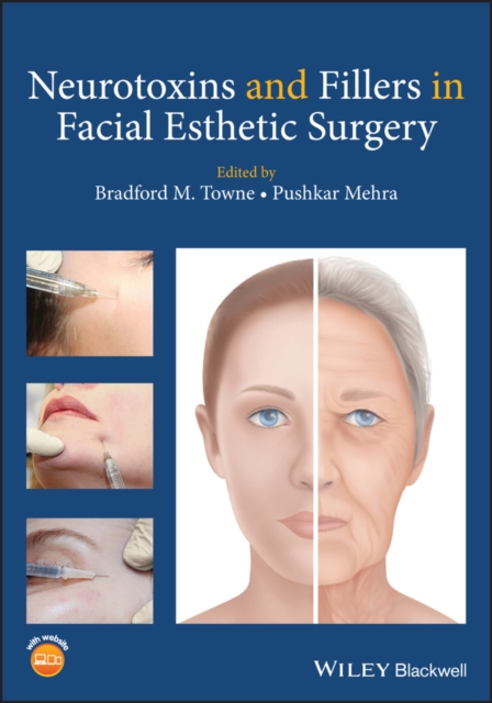 Neurotoxins and Fillers in Facial Esthetic Surgery, Paperback / softback Book